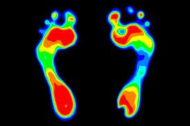 Pressure Plate Analysis